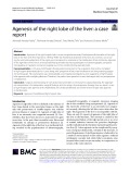 Agenesis of the right lobe of the liver: A case report