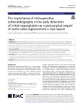 The importance of intraoperative echocardiography in the early detection of mitral regurgitation as a postsurgical sequel of aortic valve replacement: A case report