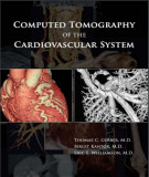 Ebook Computed tomography of the cardiovascular system: Part 2