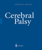 Ebook Cerebral palsy