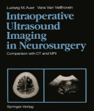 Ebook Intraoperative ultrasound imaging in neurosurgery: Comparison with CT and MRI