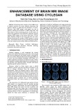 Enhancement of brain MRI image database using cyclegan