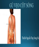 Bài giảng Gù vẹo cột sống - ThS.BS. Nguyễn Thụy Song Hà