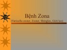 Bài giảng Bệnh Zona (Varicella zoster, Zoster, Shingles, Giời leo)