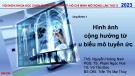 Bài giảng Hình ảnh cộng hưởng từ u biểu mô tuyến ức