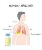 Hội chứng tràn dịch màng phổi (Bệnh học cơ sở)