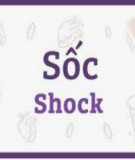 Sốc (Shock)