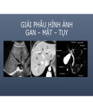 Bài giảng Giải phẫu hình ảnh gan, mật, tụy