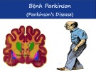 Bài giảng Bệnh Parkinson (Parkinson’s Disease)