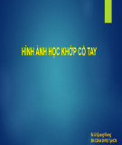 Bài giảng Hình ảnh học khớp cổ tay - BS. Lê Quang Khang